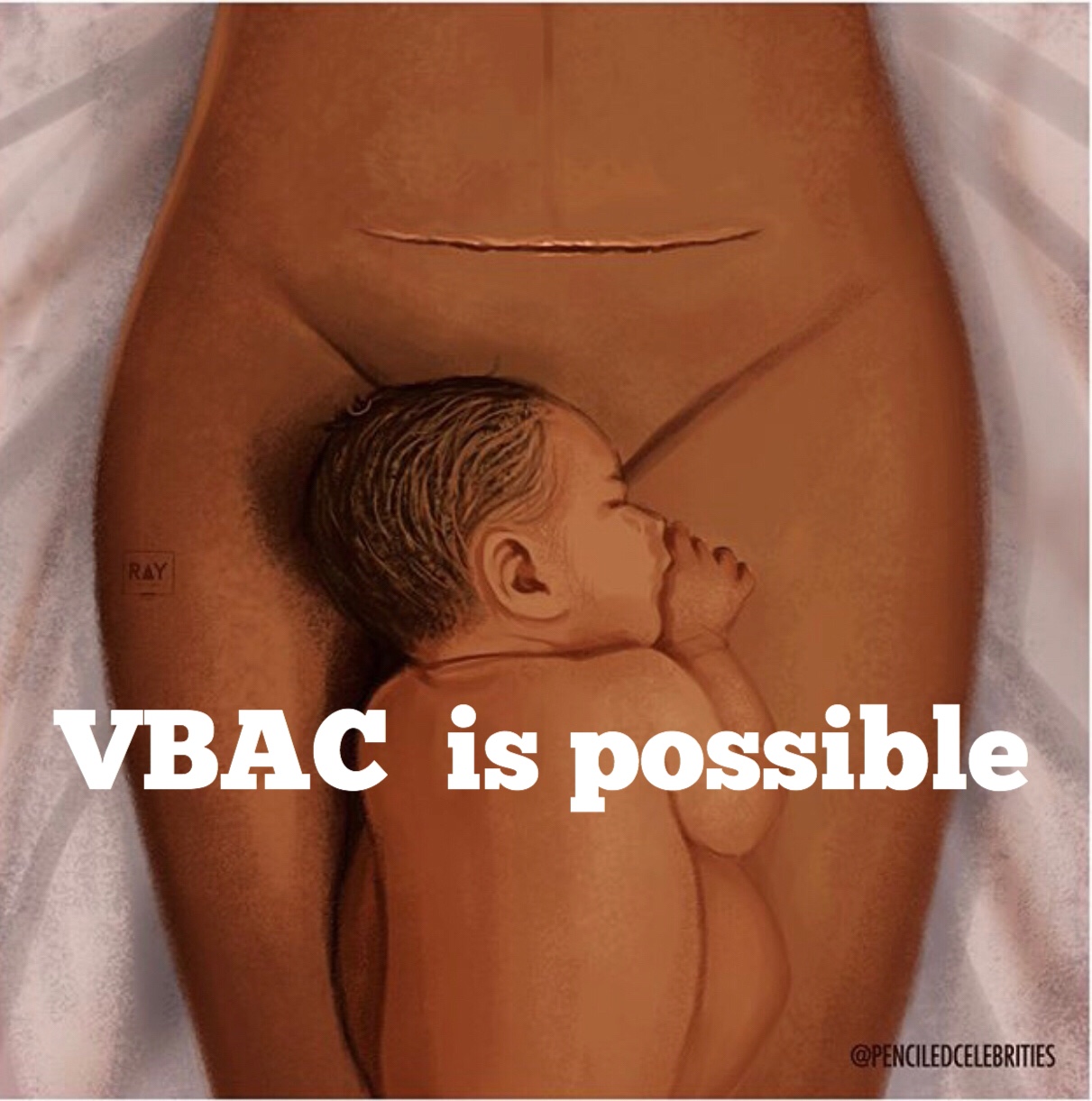 VBAC Tips