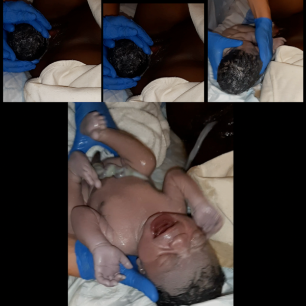 Giving Birth. second stage of labor