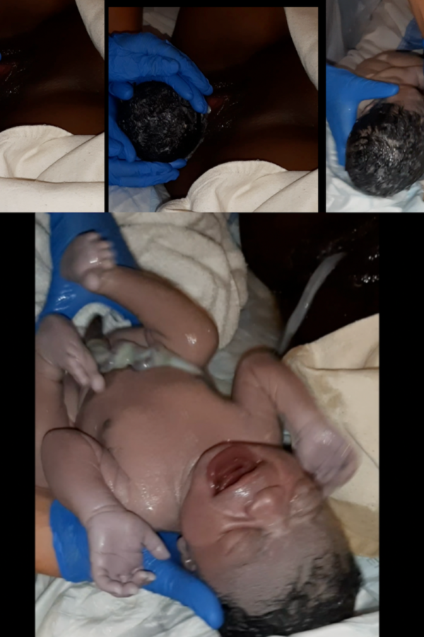 Giving Birth. second stage of labor